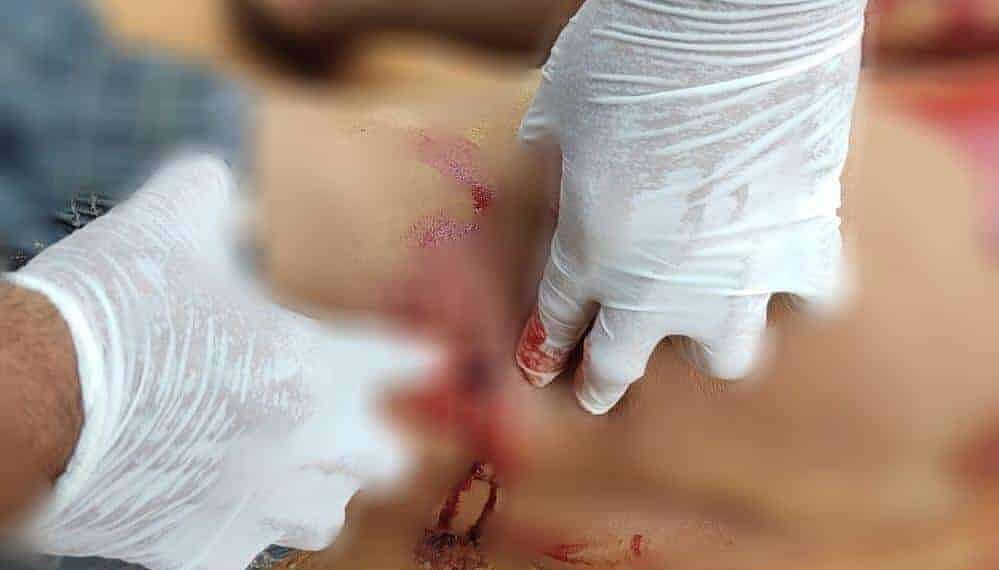 Homem é executado com vários tiros por dupla de facção rival, na região de fronteira 1 Homem é executado com vários tiros por dupla de facção rival, na região de fronteira