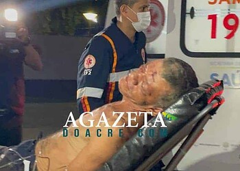 Idoso tem casa invadida e é agredido brutalmente por criminosos