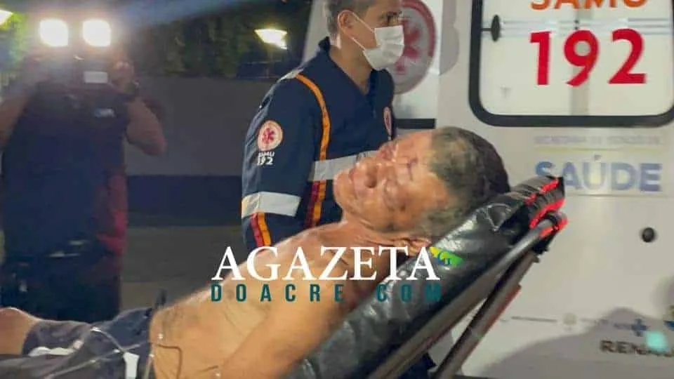 Idoso tem casa invadida e é agredido brutalmente por criminosos