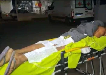 Jovem sofre descarga elétrica, fica preso em fios e tem queimaduras de terceiro grau ao tentar fazer ligação clandestina