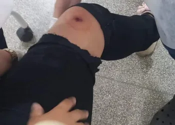 Em Rio Branco, mulher reage a assalto e é ferida a tiros por criminoso