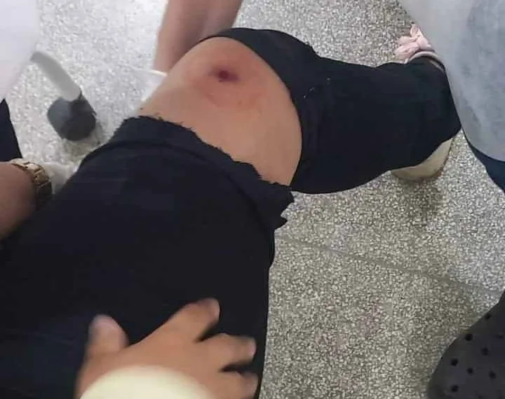 Em Rio Branco, mulher reage a assalto e é ferida a tiros por criminoso