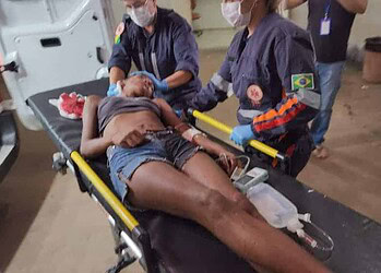 Mulher em situação de rua é ferida a golpes de terçado na cabeça e pescoço em Rio Branco