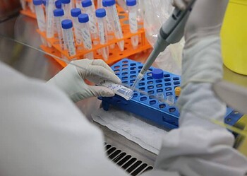 Acre registra quatro casos suspeitos de varíola do macaco