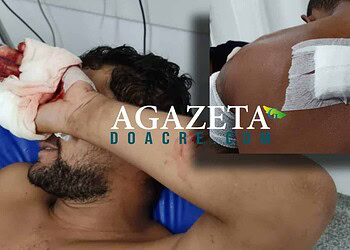 Ferido a golpes de terçado, bandido em fuga é rendido por policial a paisana em Brasileia