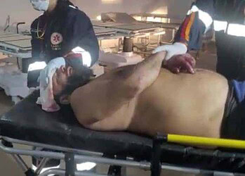 Homem leva terçadada na cabeça durante briga em Rio Branco