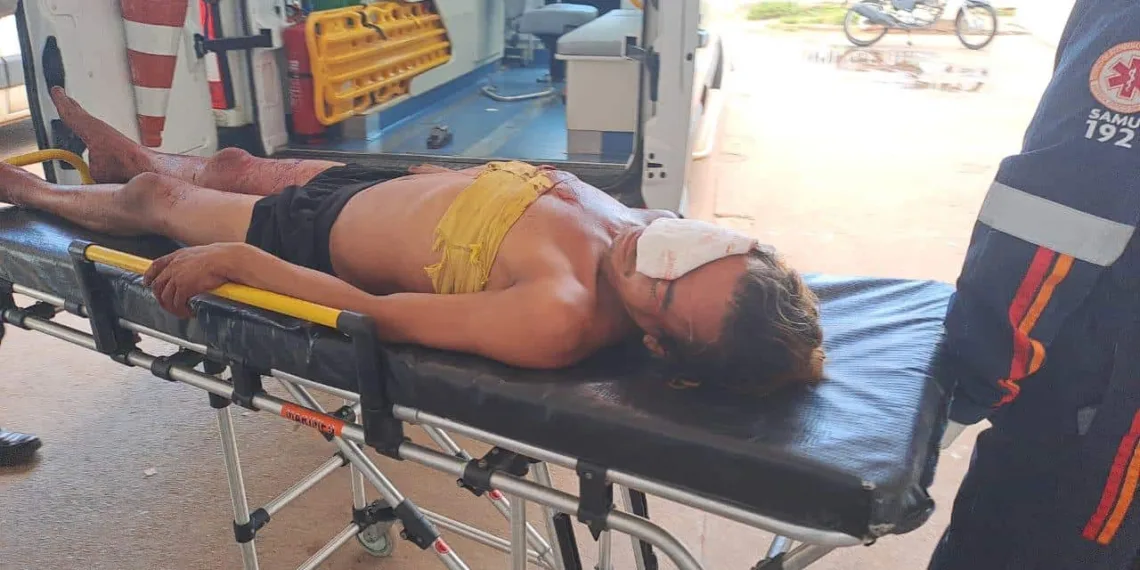 Mulher trans é ferida no olho com golpe de terçado e pode ficar cega