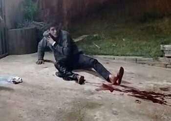 Em Xapuri, policial civil é gravemente ferido após troca de tiros com assaltante