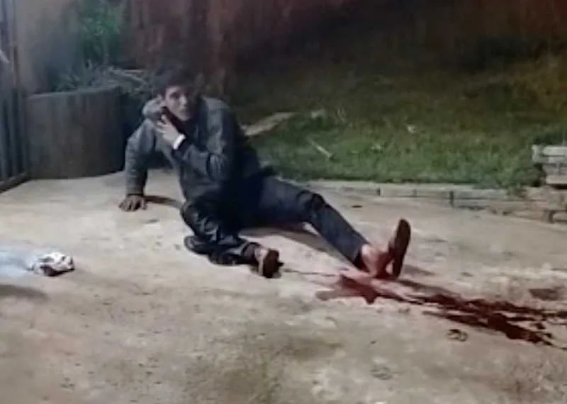 Em Xapuri, policial civil é gravemente ferido após troca de tiros com assaltante