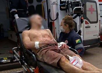 Discussão entre vizinhos termina com vítima ferida a terçadadas em Rio Branco