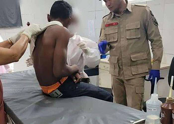 Adolescente de 14 anos é baleado com tiro acidental de espingarda no Acre