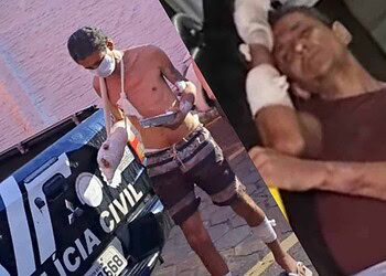 Homem esfaqueado em suposto assalto é foragido da polícia e condenado por estupro