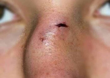 'Vou cobrar o vacilo', diz homem agredido por amigo