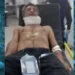 Mulher não aceita separação e tenta matar ex-marido com terçadada no pescoço