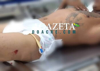 Jovem de 24 anos é baleado em frente da sua casa no Quinari