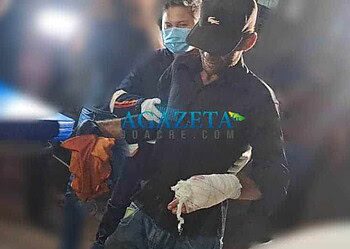 Homem é obrigado por desconhecido a estender a mão para levar um tiro