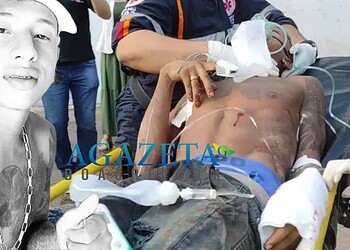 Jovem que sobreviveu a tiro no peito é preso com armas e drogas 60 dias após sair da UTI