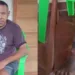 Ex-seringueiro que perdeu perna após picada de cobra pede ajuda para comprar cadeira de rodas
