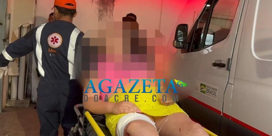 Criança de 10 anos é atingida por bala perdida em Rio Branco