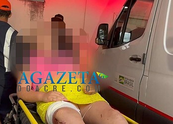 Criança de 10 anos é atingida por bala perdida em Rio Branco