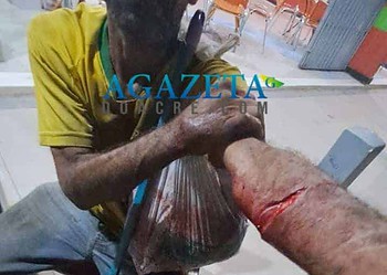 Morador de rua tem surto psicótico e se corta com uma faca