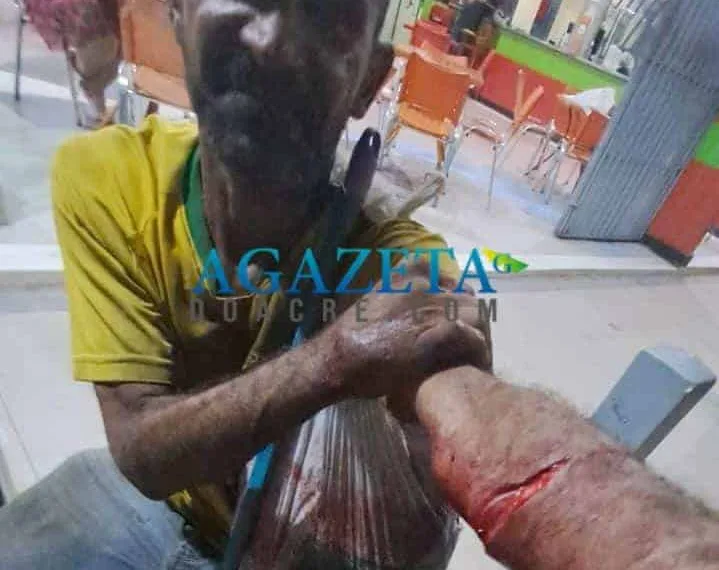 Morador de rua tem surto psicótico e se corta com uma faca