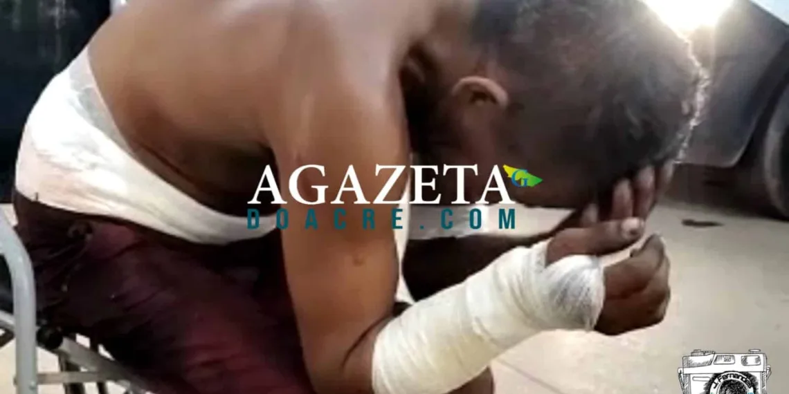 Mulher esfaqueia ex-marido em Rio Branco