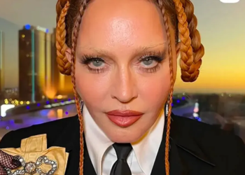 Madonna foi encontrada inconsciente e precisou ser intubada em UTI