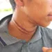 Adolescente quase é degolado ao tentar laçar vaca no Acre