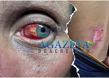 Peão é espancado por faccionados e escapa da morte após chegada da polícia