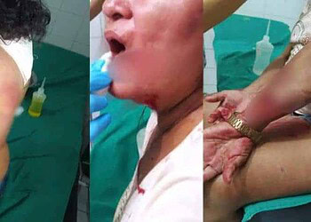 Mulher é resgatada pela polícia após ter cabelo, roupas e corpo cortados com faca pelo marido