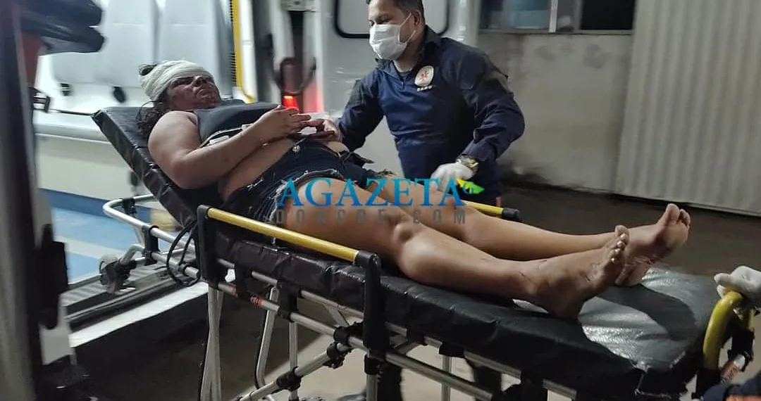 Mulher é espancada pelo marido após ele ter crise de ciúmes