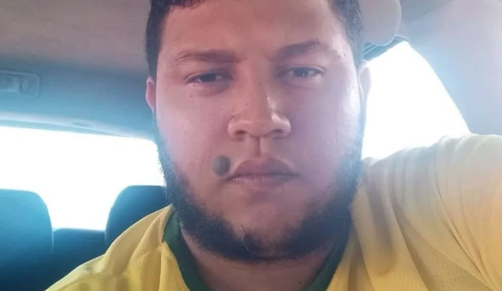 Motociclista que teve perna decepada em acidente tem quadro grave com rins paralisados
