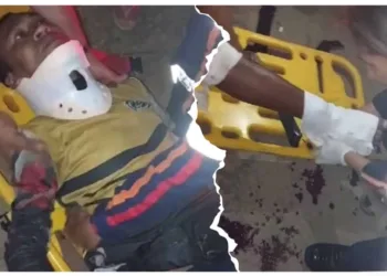 Homem sofre fratura em acidente envolvendo duas motos em Sena Madureira