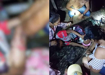 Moradora do Rio Purus é atacada por jacaré