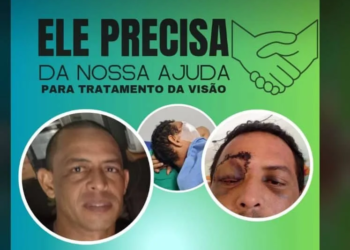 Família de policial ferido em rebelião na Antônio Amaro faz vaquinha para realizar cirurgia no olho