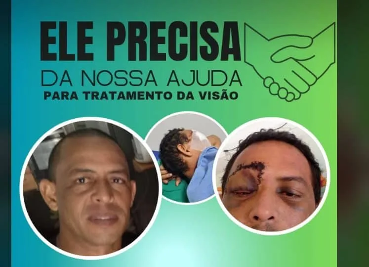 Família de policial ferido em rebelião na Antônio Amaro faz vaquinha para realizar cirurgia no olho