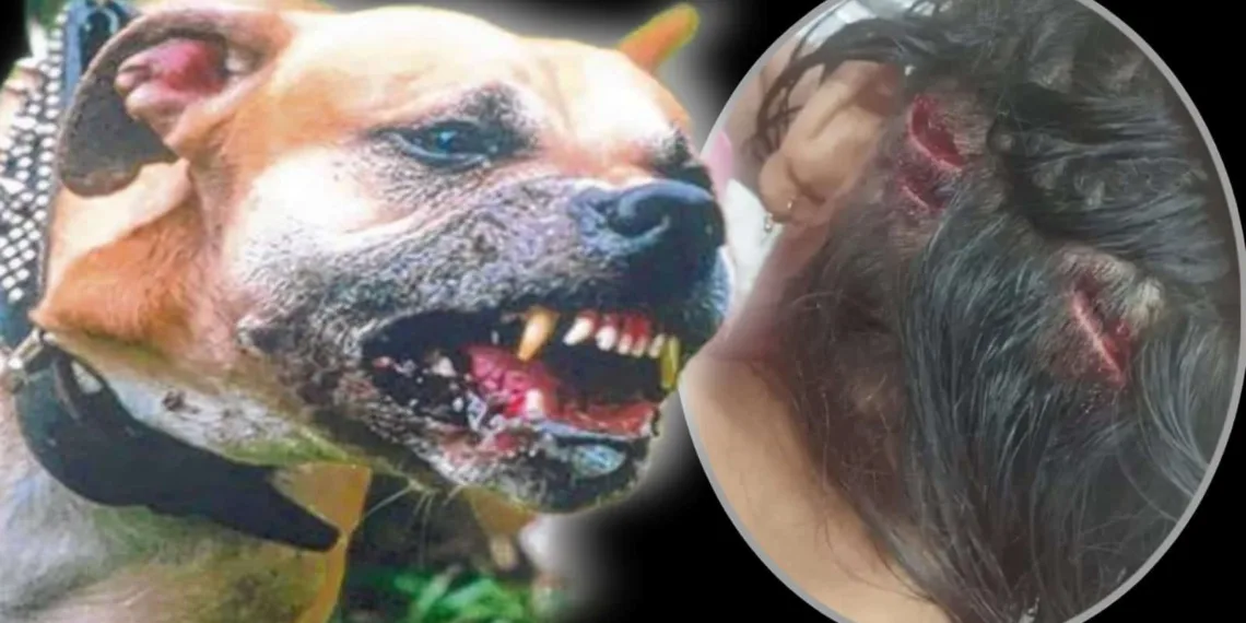 Cão da raça pitbull ataca criança de 5 anos no interior do Acre