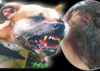 Cão da raça pitbull ataca criança de 5 anos no interior do Acre