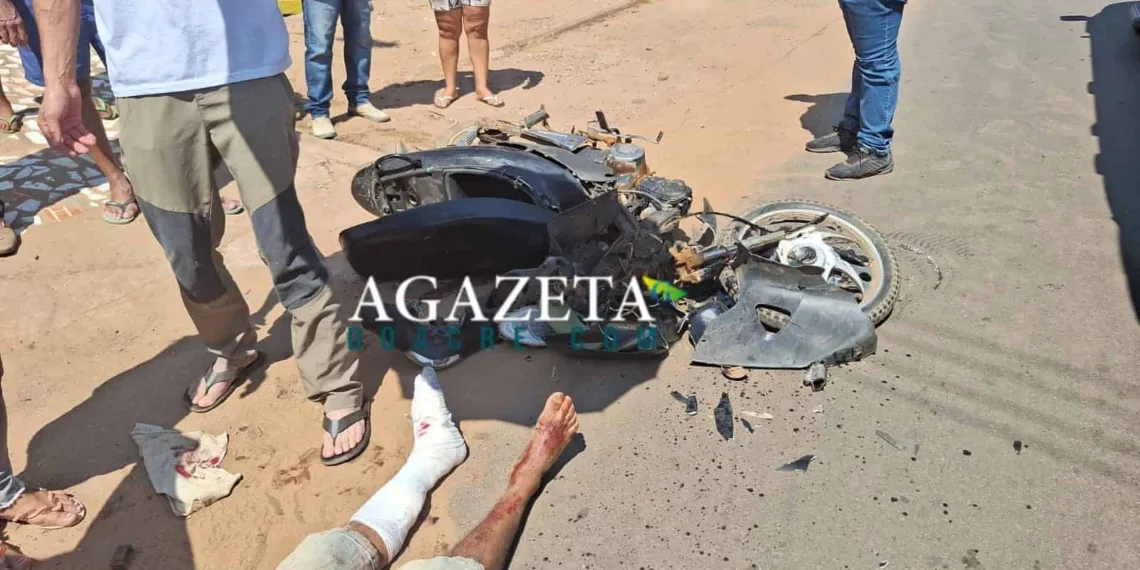 Casal em motocicleta fica gravemente ferido após colidir contra caminhão no interior do Acre