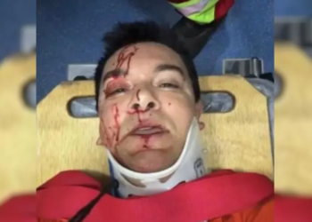 Cantor Regis Danese passa por cirurgia no intestino e segue internado na UTI