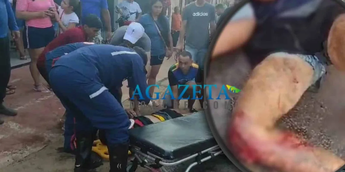 Colisão: motociclista quase tem perna amputada e o outro fica em estado grave