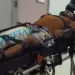 Homem sofre tentativa de homicídio e tem fêmur dilacerado ao ser alvejado com tiro