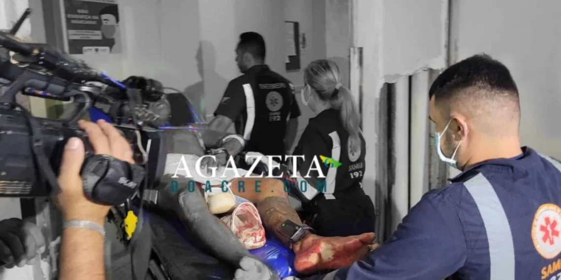 Homem leva tiro de escopeta nas pernas em via pública de Rio Branco