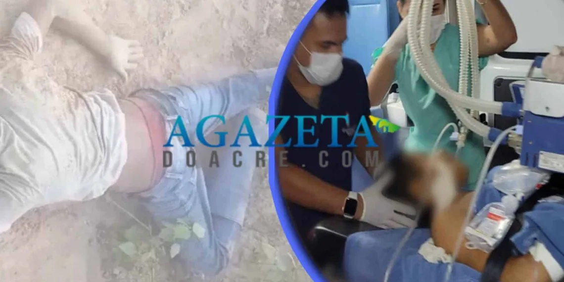 Adolescente toma tiro acidental durante caçada e fica em estado gravíssimo