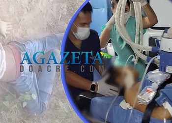 Adolescente toma tiro acidental durante caçada e fica em estado gravíssimo