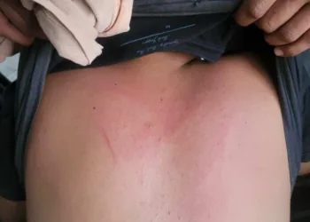 Policial penal é acusado de agredir criança com autismo no interior do Acre
