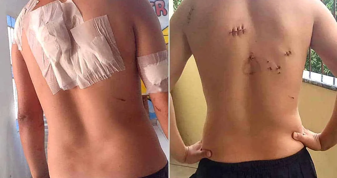 Homem esfaqueado em tentativa de assalto no Centro de Rio Branco sobrevive: 'Deus me ama'
