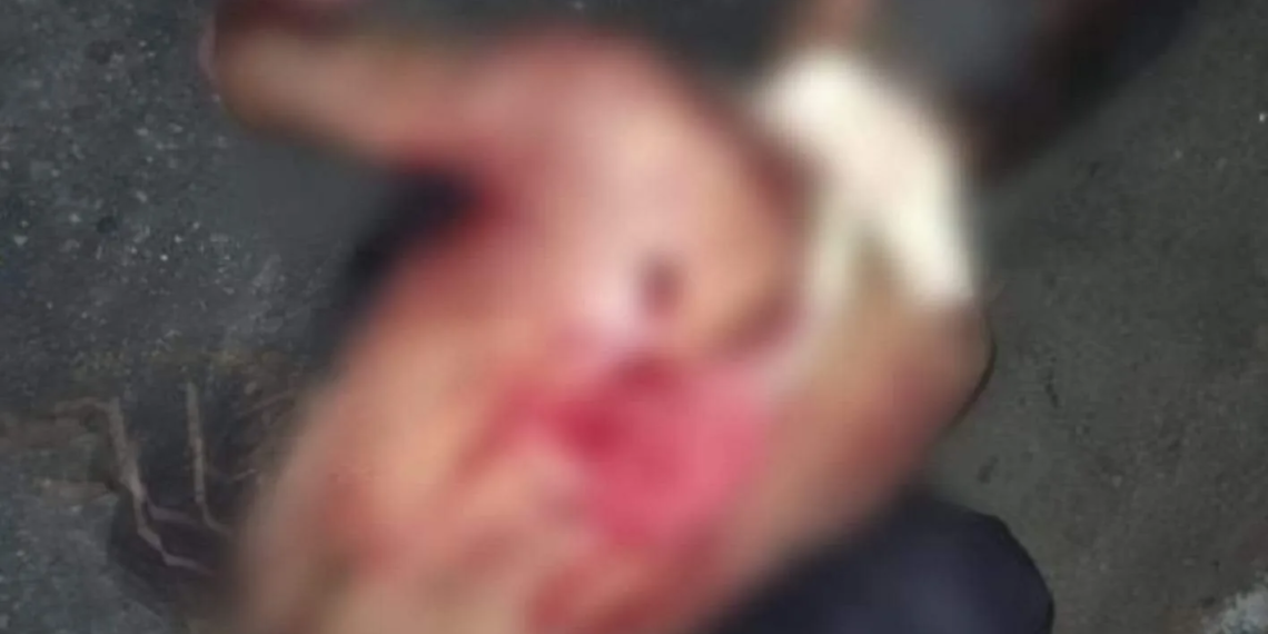Homem é ferido a golpes de faca após ser sequestrado no bairro Seis de Agosto