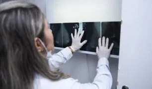 Acre institui programa que garante reabilitação fisioterapêutica para mulheres mastectomizadas